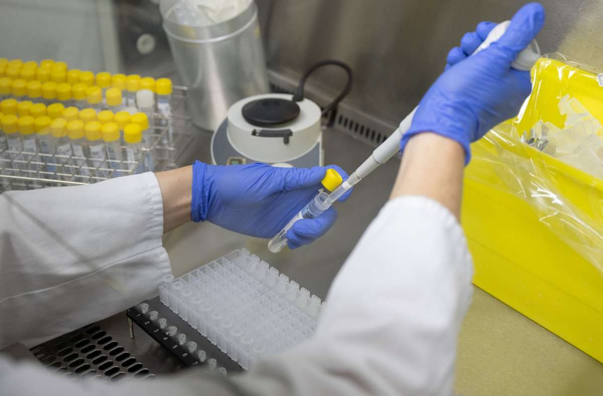 Angesichts wachsender Neuinfektionen: Stadt Stuttgart erhöht Kapazität an PCR-Tests deutlich