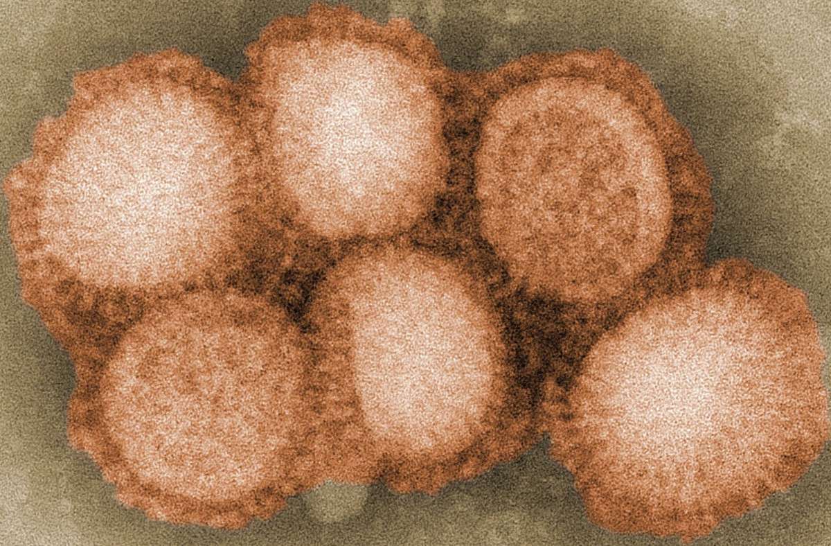 Schweinegrippe-Virus in Kanada: Seltener Fall von Schweinegrippe-Infektion beim Menschen