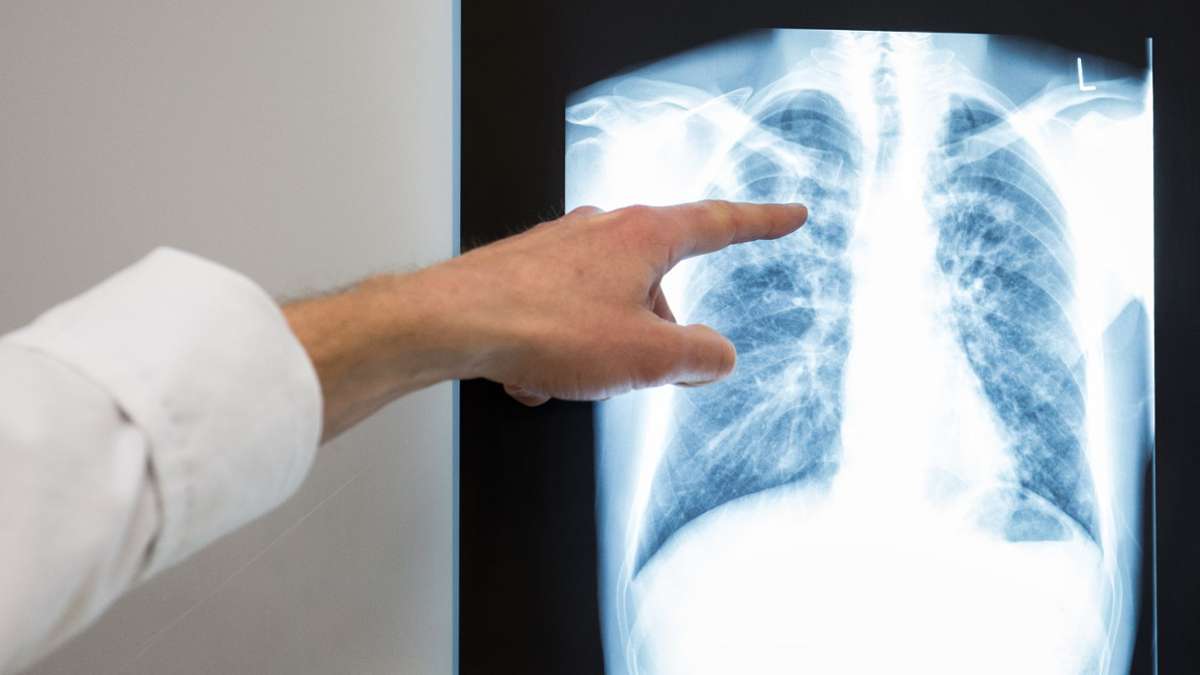 Krankheiten: Tuberkulose-Fallzahlen in Deutschland leicht gestiegen