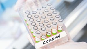 Schnelle PCR-Tests: Sind sie die Lösung?