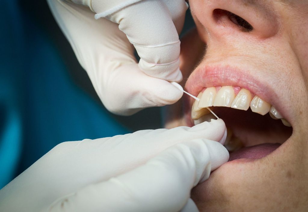 Konkurrent hatte geklagt: Zahnarzt darf keine Fake-Bewertungen mehr posten