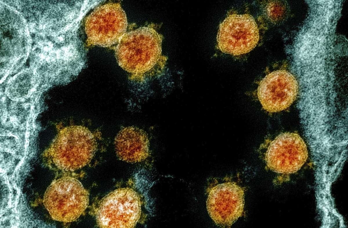 Diese elektronenmikroskopische Aufnahme des National Institute of Allergy and Infectious Diseases Integrated Research Facility (Fort Detrick,  US-Bundesstaat Maryland)   zeigt  Partikel des Coronavirus  (orangefarben), die von einem Patienten isoliert wurden.