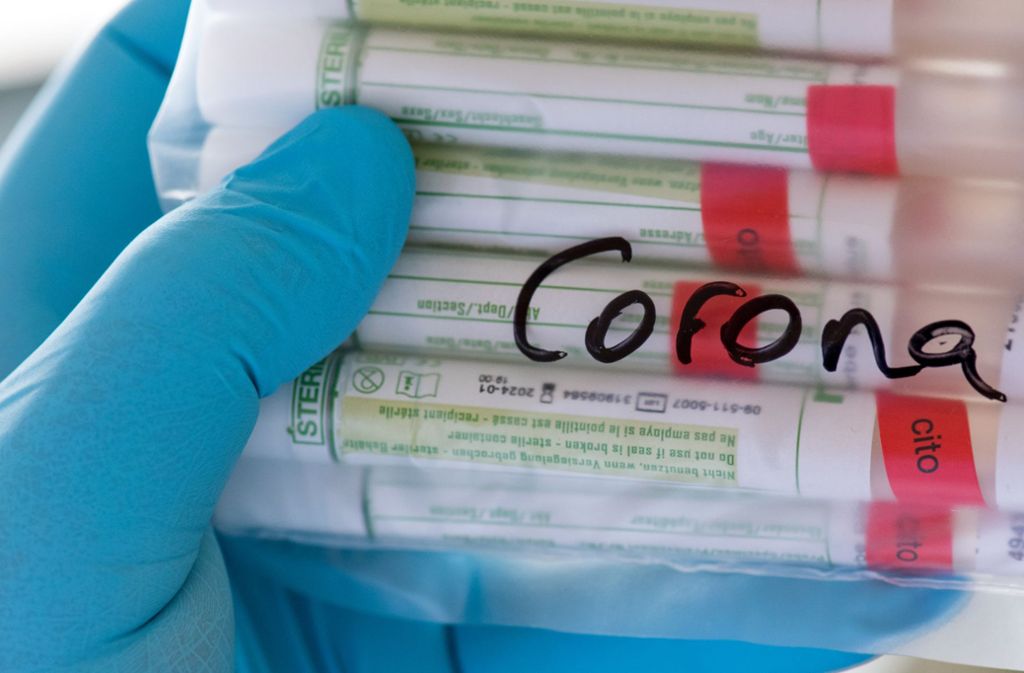 Coronavirus in Stuttgart: Alarm bei 307 Neuinfektionen  in einer Woche