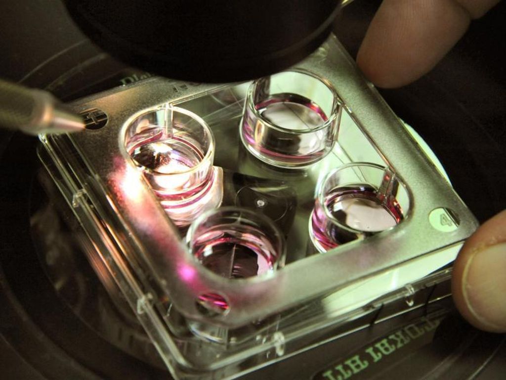 Regierungsbericht: Mehr Gentests an Embryonen zugelassen