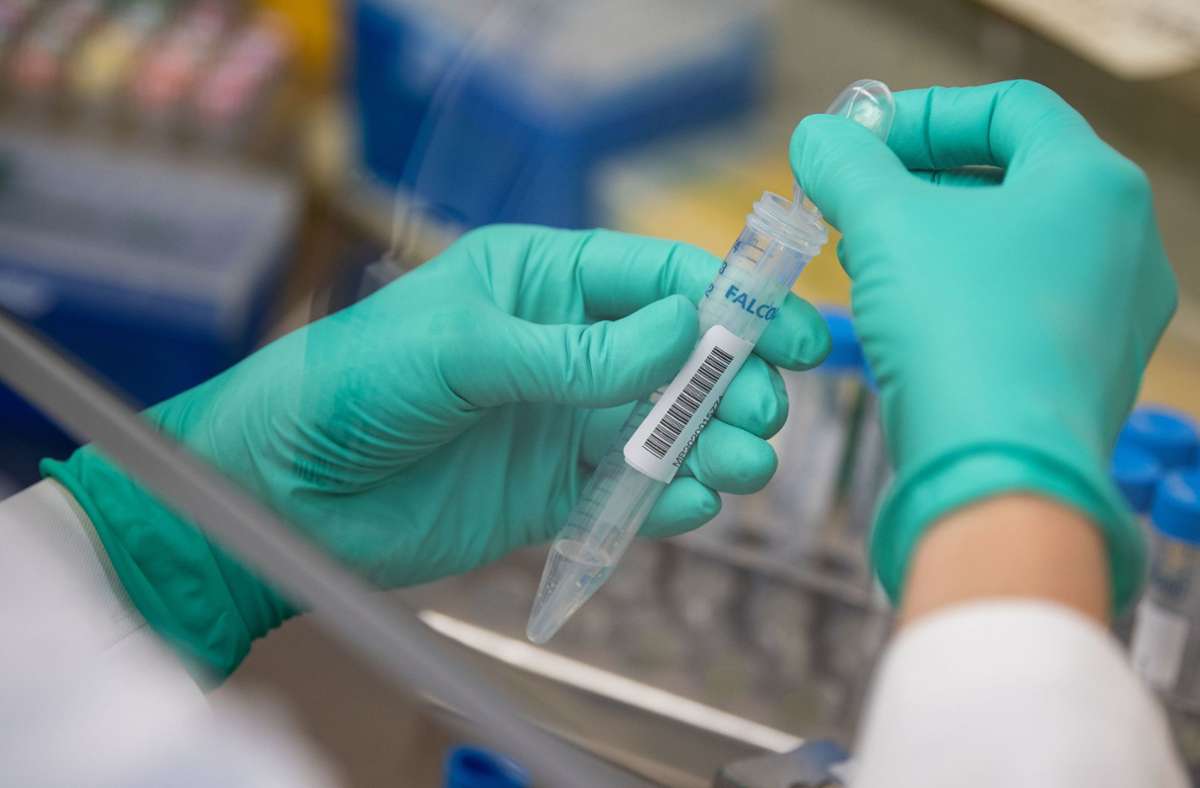 Coronavirus in Baden-WÜrttemberg: Überlastete Labore: Getestete müssen länger warten
