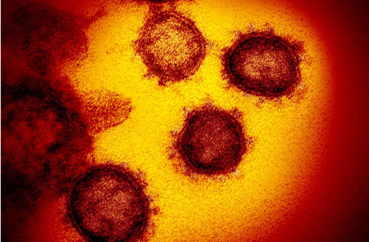 Auswirkungen von Corona: Feindliche Übernahme – So zerstört  das Coronavirus  menschliche Zellen